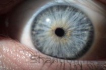 狗狗掉毛皮肤发红还有结痂的小疙瘩是什么情况？